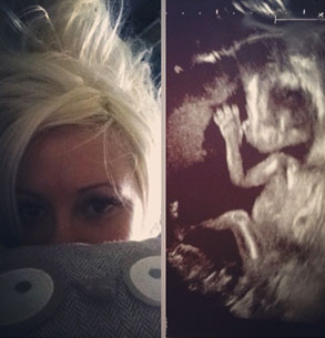 Holly Madison, Sonogram, Twit Pic Holly Madison, Sonogram, Twit Pic
